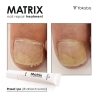Matrix nail repair Yokaba